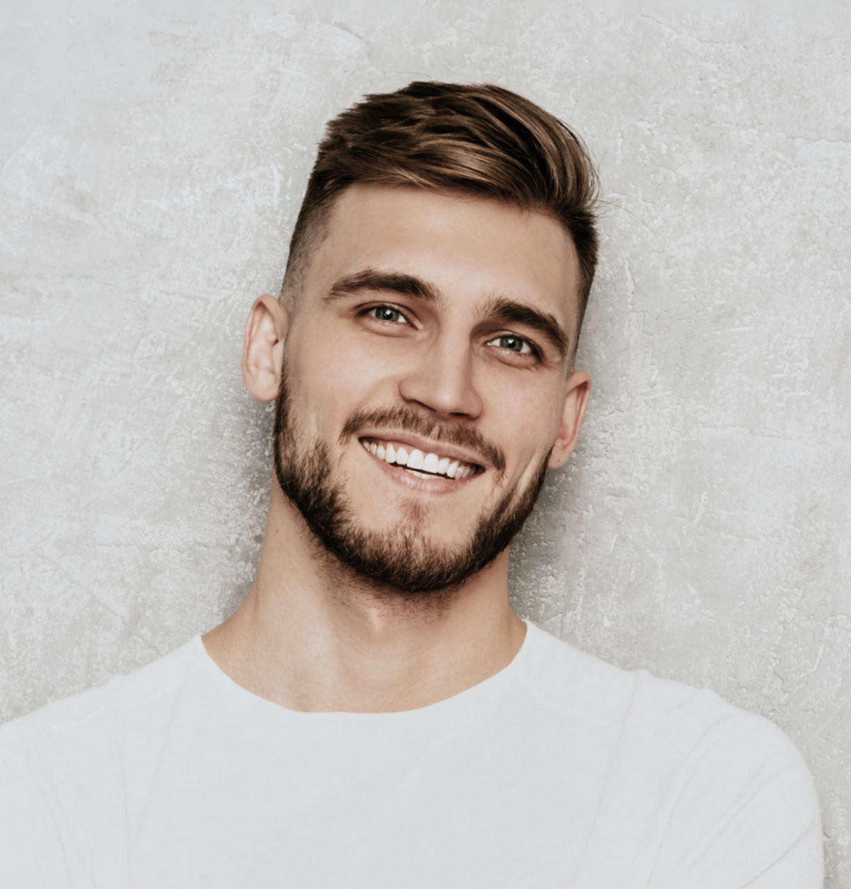 Patient after aligner treatment